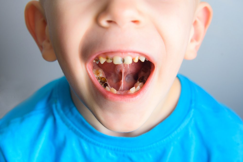 Преимущества посещения детского стоматолога